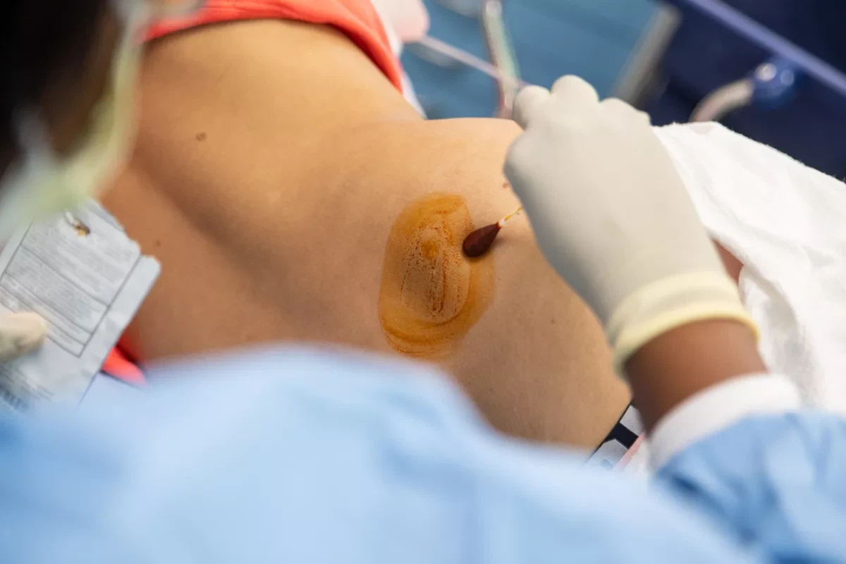 Pojasnjeno biopsijo kostnega mozga: postopek, uporabe in okrevanje