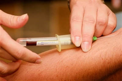 Spinalna igla + proizvajalec: trendi v panogi in napovedi prihodnjih izzivov